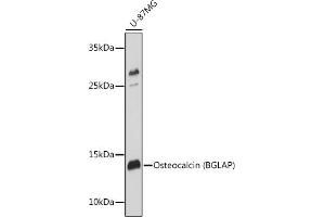 Western blot analysis of extracts of U-87MG cells, using Osteocalcin (BGLAP) antibody (ABIN6134565, ABIN6137546, ABIN6137547 and ABIN6221793) at 1:1000 dilution. (Osteocalcin antibody  (AA 1-100))