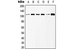 Western Blotting (WB) image for anti-Glutamate Receptor, Metabotropic 6 (GRM6) (C-Term) antibody (ABIN7295830)