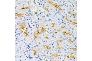 Immunohistochemistry of paraffin-embedded rat kidney using CASP9 antibody at dilution of 1:100 (x40 lens). (Caspase 9 antibody)