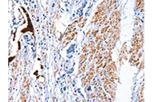 CATSPER1 antibody