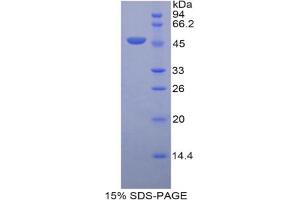 SDS-PAGE analysis of Rat LRG1 Protein. (LRG1 Protein)