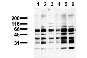 Western Blotting (WB) image for anti-Phosphoserine (phosphorylated) antibody (ABIN126865) (Phosphoserine antibody  (phosphorylated))