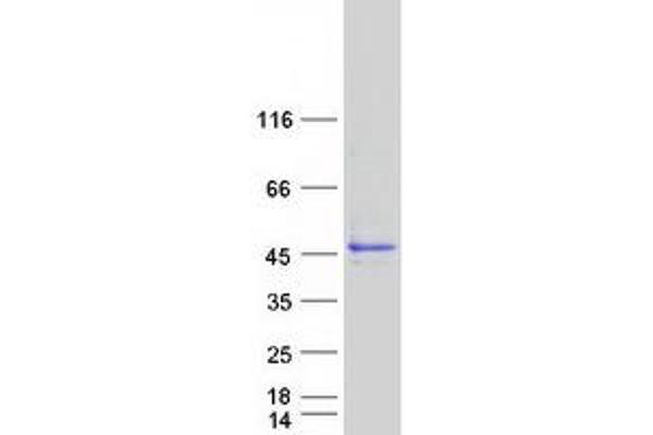 C20orf7 Protein (Transcript Variant 1) (Myc-DYKDDDDK Tag)