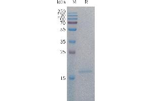 Human IL4 Protein, His Tag on SDS-PAGE under reducing condition. (IL-4 Protein (AA 25-153) (His tag))