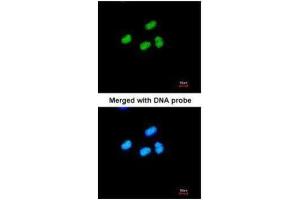 ICC/IF Image Immunofluorescence analysis of paraformaldehyde-fixed HeLa, using ATRX, antibody at 1:200 dilution. (ATRX antibody  (C-Term))