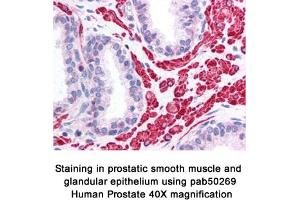 Image no. 1 for anti-Optic Atrophy 1 (Autosomal Dominant) (OPA1) (AA 500-600), (Internal Region) antibody (ABIN363578) (OPA1 antibody  (Internal Region))