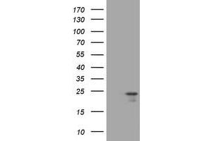 Image no. 1 for anti-Visinin-Like 1 (VSNL1) (AA 2-191) antibody (ABIN1491145) (VSNL1 antibody  (AA 2-191))