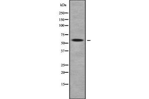 Western blot analysis of MOT9 using COLO205 whole cell lysates (SLC16A9 antibody  (Internal Region))