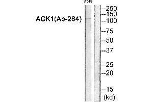 Western blot analysis of extracts from A549 cells, using ACK1 (Ab-284) Antibody. (TNK2 antibody  (Internal Region))