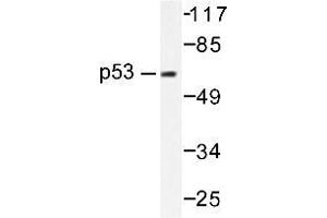 Western blot (WB) analysis of p53 antibody in extracts from HT-29 cells. (p53 antibody)