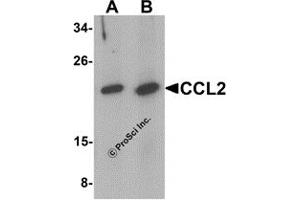 Western Blotting (WB) image for anti-Chemokine (C-C Motif) Ligand 2 (CCL2) (C-Term) antibody (ABIN1077434) (CCL2 antibody  (C-Term))