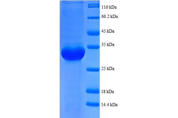 RPL35 Protein (AA 7-64, partial) (GST tag)