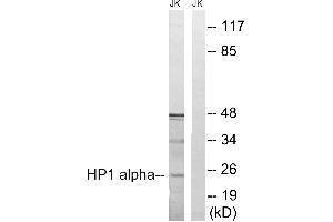 Immunohistochemistry analysis of paraffin-embedded human braina tissue using HP1α (Ab-92) antibody. (CBX5 antibody  (Ser92))