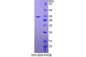 Image no. 1 for RAB5A, Member RAS Oncogene Family (RAB5A) (AA 1-214) protein (His tag) (ABIN6237618) (RAB5 Protein (AA 1-214) (His tag))