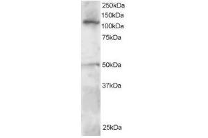 Image no. 1 for anti-Helicase-Like Transcription Factor (HLTF) (C-Term) antibody (ABIN374218) (HLTF antibody  (C-Term))