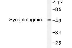 Western blot (WB) analysis of Synaptotagmin antibody in extracts from 293 cells Forskolin 40nM 30' or 293 cells Sorbitol 0. (SYT1 antibody)