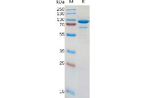 Human CD73 Protein, hFc Tag on SDS-PAGE under reducing condition. (CD73 Protein (AA 27-549) (Fc Tag))