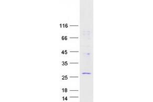 RWDD1 Protein (Transcript Variant 3) (Myc-DYKDDDDK Tag)