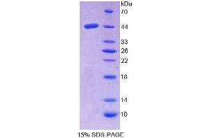 SDS-PAGE (SDS) image for Niemann-Pick Disease, Type C2 (NPC2) (AA 20-151) protein (His tag,GST tag) (ABIN4990909) (NPC2 Protein (AA 20-151) (His tag,GST tag))