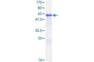 Image no. 1 for Lactate Dehydrogenase B (LDHB) (AA 1-334) protein (GST tag) (ABIN1309269) (LDHB Protein (AA 1-334) (GST tag))