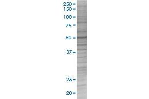 PPM1B transfected lysate. (PPM1B 293T Cell Transient Overexpression Lysate(Denatured))
