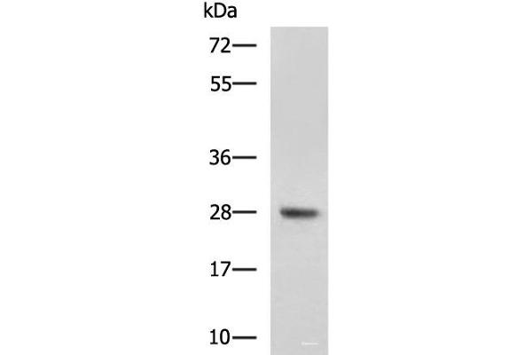 DHRS2 antibody