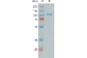 Human C1S Protein, His Tag on SDS-PAGE under reducing condition. (C1S Protein (AA 16-688) (His tag))