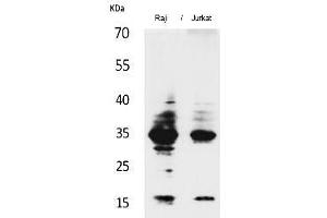 Western Blot analysis of Raji, Jurkat cells using IL-4 Polyclonal Antibody. (IL-4 antibody  (Internal Region))