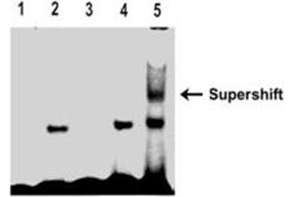 RUNX1 Protein (Transcript Variant 2) (Myc-DYKDDDDK Tag)