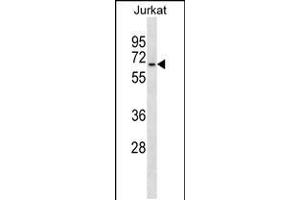 Western blot analysis in Jurkat cell line lysates (35ug/lane). (GALNT14 antibody  (N-Term))