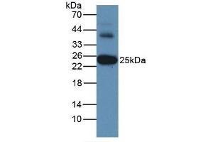 Detection of GSTa3 in Human Liver Tissue using Monoclonal Antibody to Glutathione S Transferase Alpha 3 (GSTa3) (GSTA3 antibody  (AA 1-222))