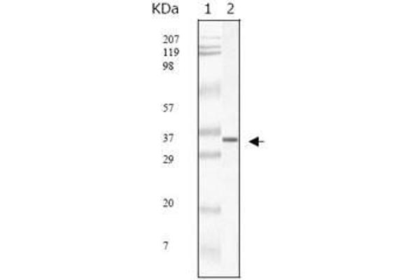 SARS-Coronavirus Membrane Protein (SARS-CoV M) antibody