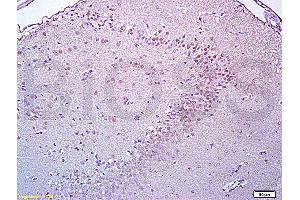 Formalin-fixed and paraffin embedded rat brain tissue labeled with Anti-Brdu Polyclonal Antibody, Unconjugated (ABIN729808) at 1:200, followed by conjugation to the secondary antibody and DAB staining (BrdU antibody)