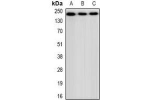 Western blot analysis of CHD4 expression in HEK293 (A), NIH3T3 (B), H9C2 (C) whole cell lysates. (CHD4 antibody)