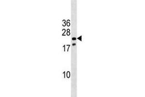 Nkx3. (NKX3-1 antibody  (AA 3-1))