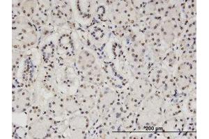 Image no. 2 for anti-Core-binding Factor, Runt Domain, alpha Subunit 2, Translocated To, 2 (CBFA2T2) (AA 201-304) antibody (ABIN599484) (CBFA2T2 antibody  (AA 201-304))