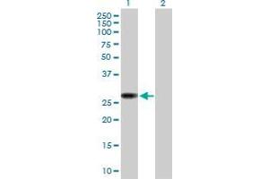 Lane 1: NAT9 transfected lysate ( 22. (NAT9 293T Cell Transient Overexpression Lysate(Denatured))