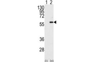 Western Blotting (WB) image for anti-Macrophage Stimulating 1 (Hepatocyte Growth Factor-Like) (MST1) antibody (ABIN3003576) (MST1 antibody)