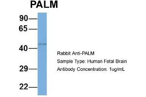 Host: Rabbit  Target Name: PALM  Sample Tissue: Human Fetal Brain  Antibody Dilution: 1. (Paralemmin antibody  (N-Term))