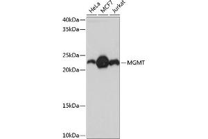 Western blot analysis of extracts of various cell lines, using MGMT Rabbit mAb (ABIN7269075) at 1:1000 dilution. (MGMT antibody)