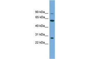 Image no. 1 for anti-IMP (Inosine 5'-Monophosphate) Dehydrogenase 2 (IMPDH2) (N-Term) antibody (ABIN6745056) (IMPDH2 antibody  (N-Term))