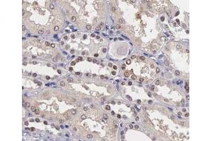 ABIN6267405 at 1/200 staining human kidney tissue sections by IHC-P. (Stathmin 1 antibody  (pSer25))