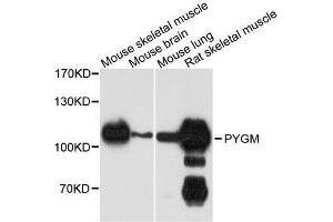Western blot analysis of extracts of various cell lines, using PYGM antibody (ABIN5996284) at 1/1000 dilution. (PYGM antibody)
