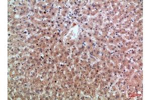 Immunohistochemical analysis of paraffin-embedded Human-liver, antibody was diluted at 1:100 (Epiregulin antibody  (AA 71-120))