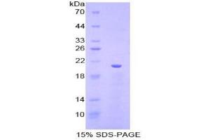 SDS-PAGE analysis of Pig vWF Protein. (VWF Protein)