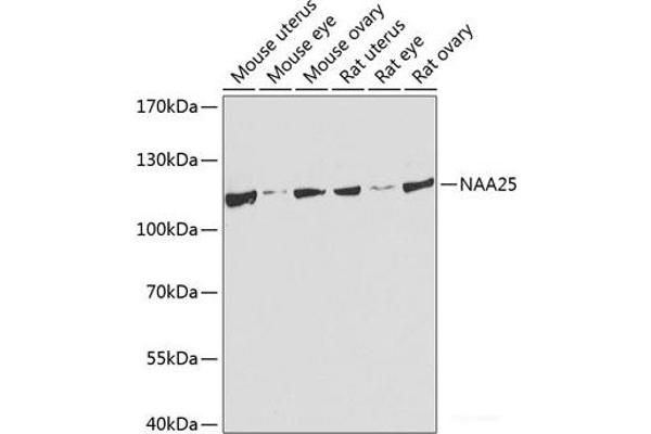 NAA25 抗体