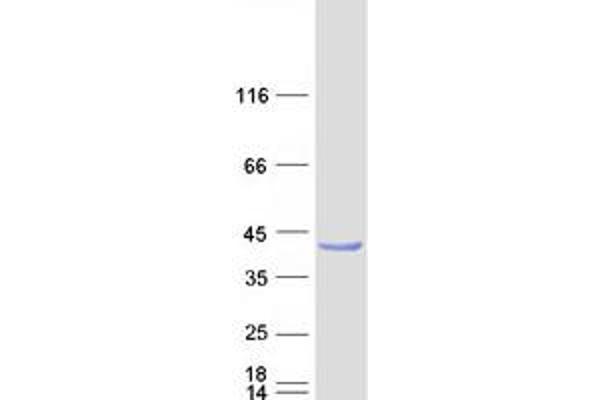 PPIL6 Protein (Transcript Variant 1) (Myc-DYKDDDDK Tag)