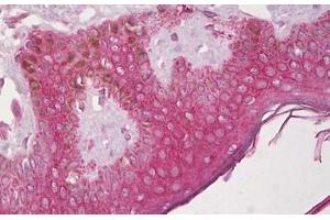 Anti-CXCR4 antibody IHC staining of human skin, epidermis. (CXCR4 antibody  (N-Term))