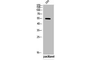 Western Blot analysis of 293 cells using Phospho-Vimentin (S83) Polyclonal Antibody (Vimentin antibody  (pSer83))
