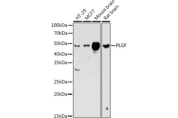 PLGF antibody  (AA 19-170)